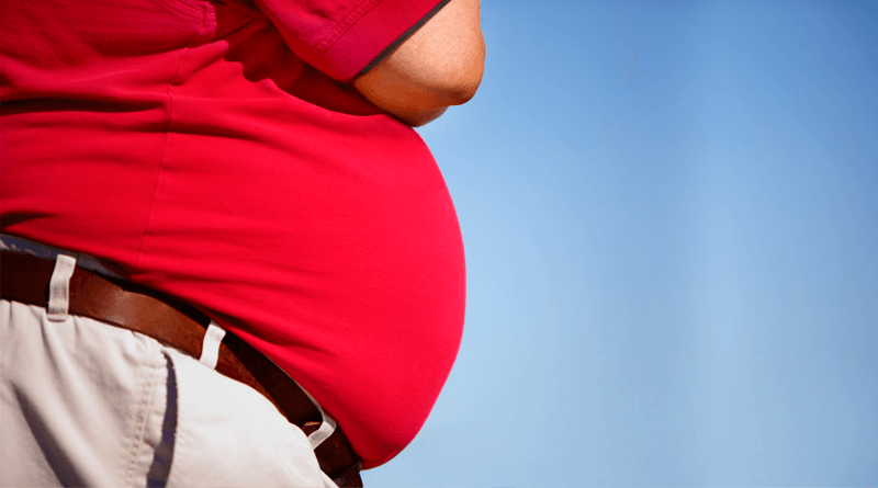 Obesity Causes Diagnosis Complications and Treatment