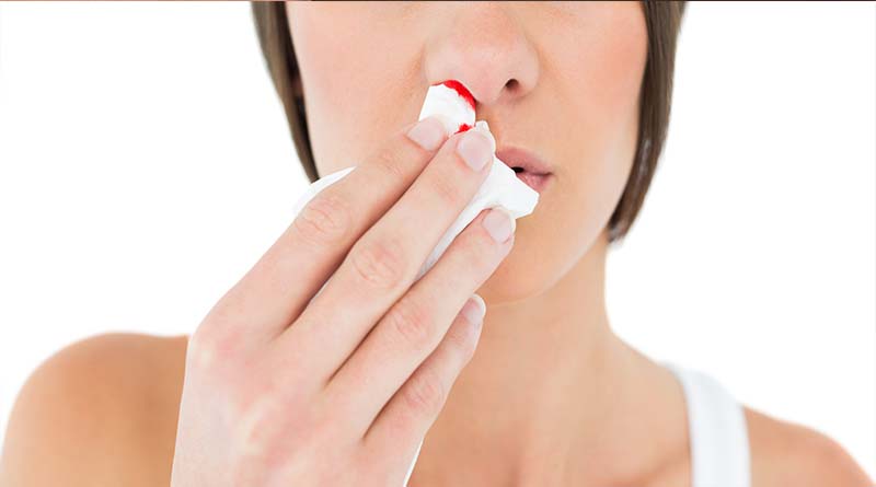 Reasons of Nose Bleeding and Remedies